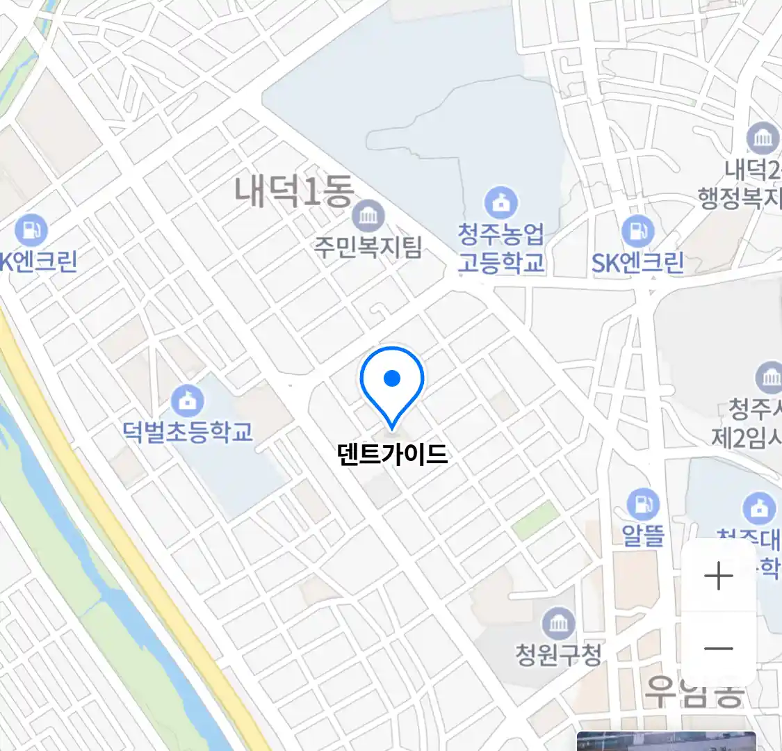 덴트가이드